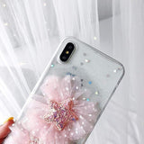 Lace x Fluffy Flower iPhone Case The Ambiguous Otter